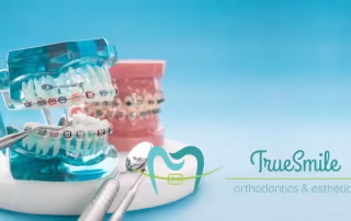 dental braces